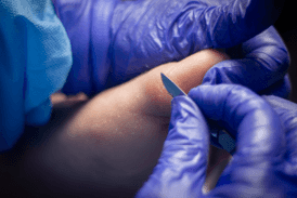 podologia galeria (20)